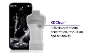 Vscan Air™ raises the bar for handheld ultrasound image quality