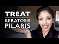 KERATOSIS PILARIS from DOCTOR V | KP Treatment |chicken skin | How to treat KERATOSIS PILARIS | DR V