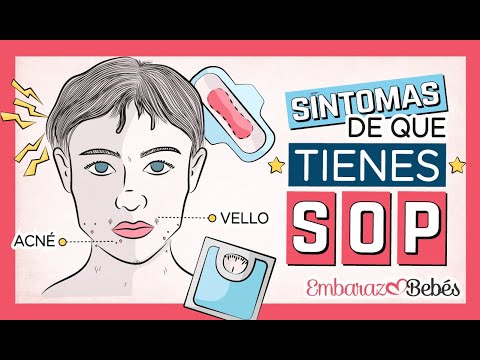 Video: Cómo reconocer los síntomas del síndrome de ovario poliquístico