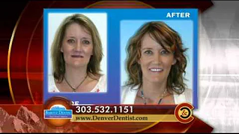 Barotz Dental - Colorado and Company (July 2013)