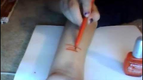 Howto: Cope with Self-Harm, Eating Disorders, and Anxiety.