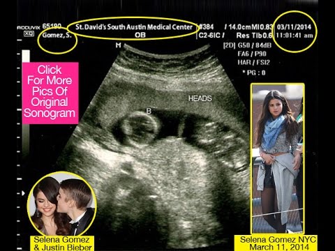 Justin Bieber Selena Gomez Pregnant