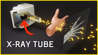 How an X-Ray Tube Works⚡How X-Rays are Generated