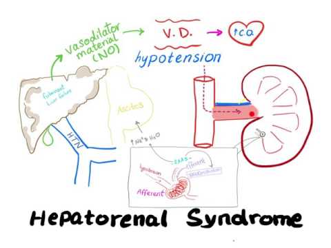 Hepatorenal Syndrome mechanism