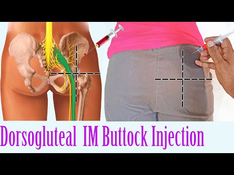 injection im buttocks intramuscular give dorsogluteal hip technique