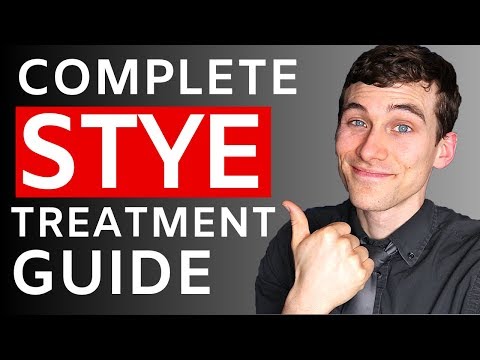 How to Get Rid van een Stye op het ooglid - Compleet Tutorial met Q & A