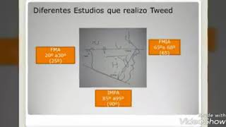 Cephalometrics in Orthodontics (14.3) by Dr. Ronny Aung