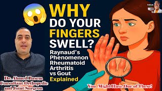 Why Your Fingers Swell | Raynaud’s Phenomenon vs Rheumatoid Arthritis vs Gout Explained