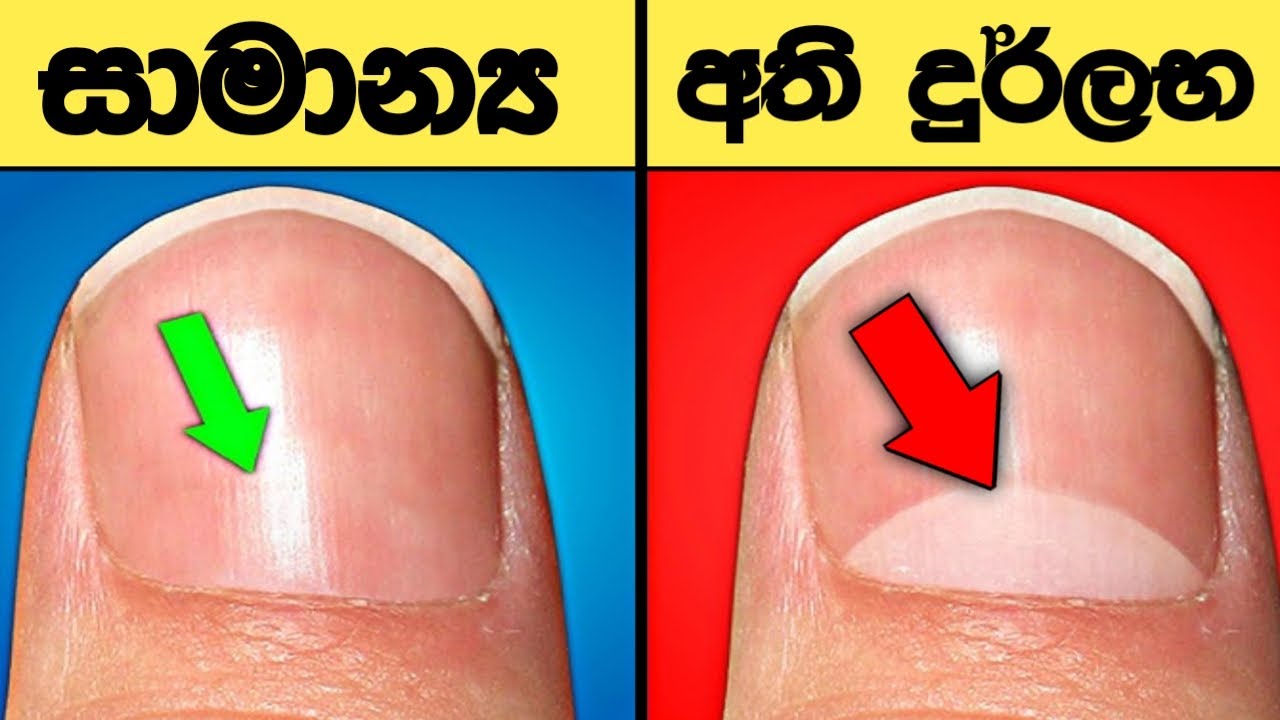 මේ අඩසද සලකුන තියෙන අය ඉතා බලගතුයි - මන් කියන විදියට ප්‍රාර්තනාවක් කරොත් අනිවාර්‍යෙන්ම ඉශ්ඨ වේවී.