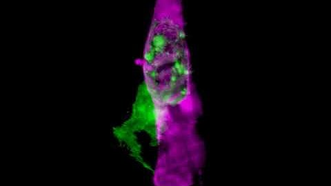 Cancer cell migration in a zebrafish xenograft model