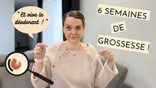 6 Sa De Grossesse, Symptôme Précoce, Échographie De Datation