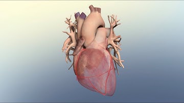 How Coronary Artery Disease Can Lead to a Heart Attack