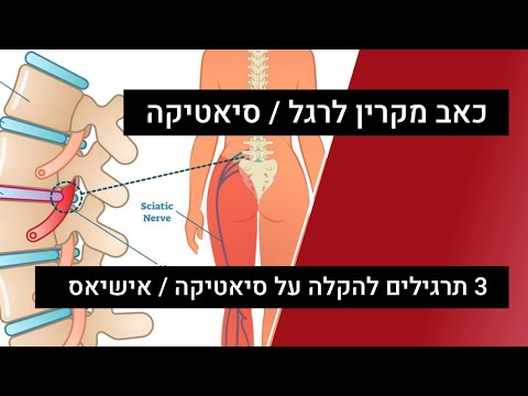 וִידֵאוֹ: הפחתת כאבי סיאטיקה: איך לעצור את הגב, הירכיים והרגליים