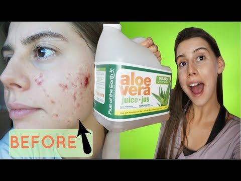 clear-your-skin-in-one-week-drinking-pure-aloe-vera-juice-||-hormonal-acne