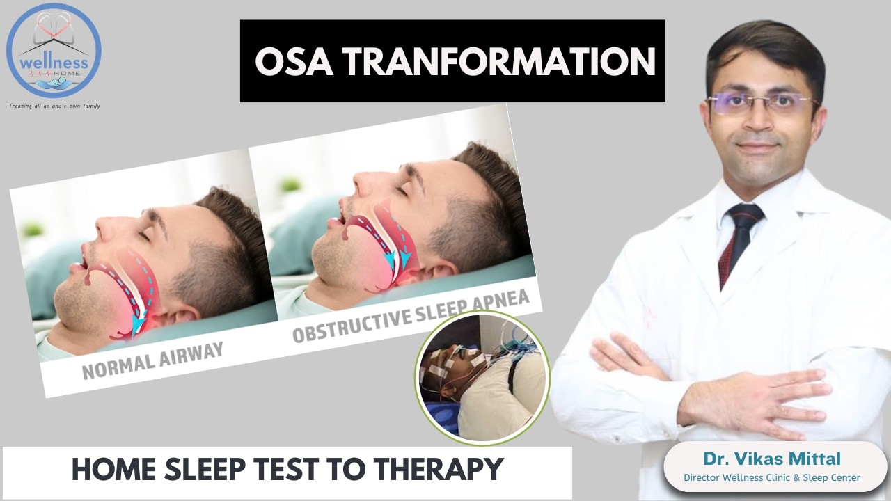 OSA Explained: Symptoms, Sleep Testing & Tailored Therapy Plan | Sleep ...