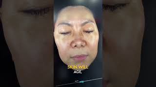 How AI Is Transforming the Future of Dermatology and Skin Analysis