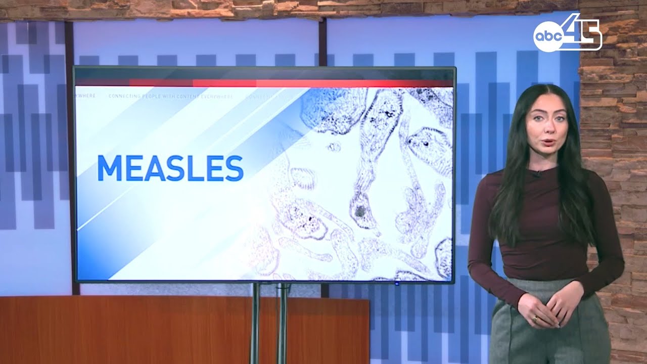 Measles cases on the rise, Triad doctor talks prevention