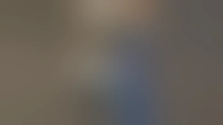 EVO ICL | 20/20 Vision just Minutes After Procedure