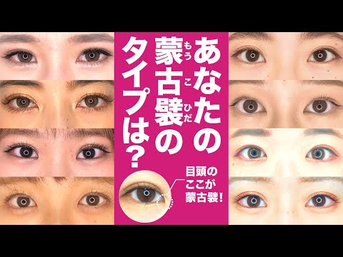 【鏡でチェック】あなたの蒙古襞（もうこひだ）のタイプは？