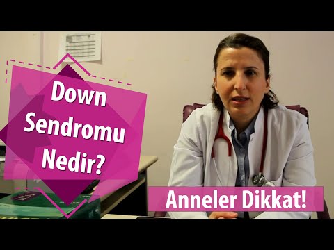 Down Sendromu Nedir?  Belirtileri ve Tedavi yöntemleri Uzm. Dr. Hatice DEMİR