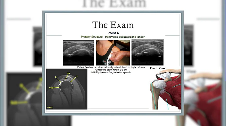 Dr. Christopher Baker, Ultrasound of the Shoulder ...