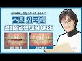 중년 외국인 개방교합 인비절라인 치아교정 사례 - 해외에서도 찾는 교정 치료 클라스乃 【치아교정잘하는곳 오리건치과】