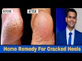 Home Remedy To Get Rid Of  Cracked Heels Fast