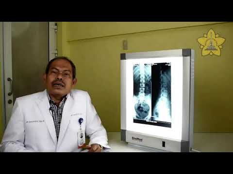 Pembacaan Foto Polos Lumbosacral - Dr. dr. Iskandar Zakaria, Sp. Rad (K) RI