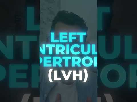 What Is An Enlarged Heart