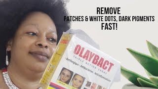 OLAYBACT TRIPLE ACTION CREAM REVIEW|HOW TO PROTECT SKIN WHEN USING LIGHTENING CREAMS #Whitepatches