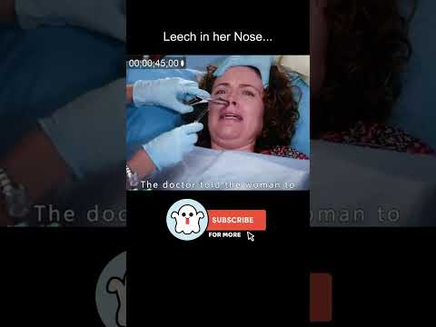 She had a Leech in her Nose...