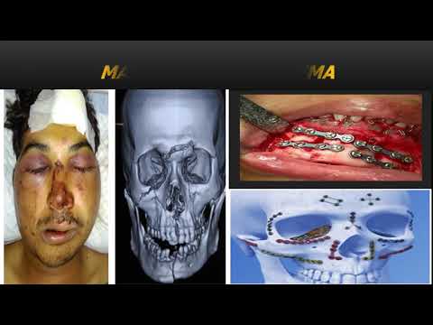maxillofacial surgery oral