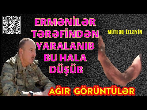 Video: Baca süpürmə jurnalları effektivdirmi?