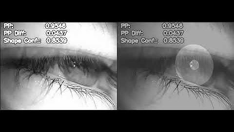 Pupil and Iris detection under extreme conditions