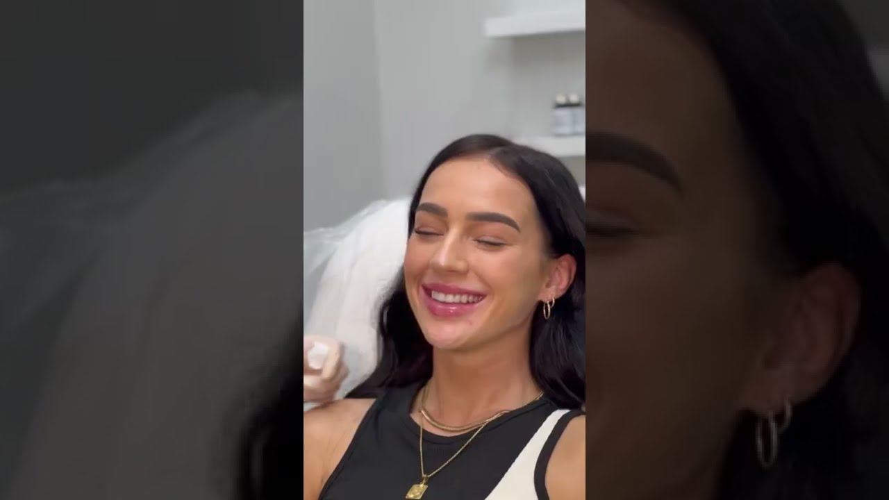 Injecting Jawline and Chin Filler at The Image Center