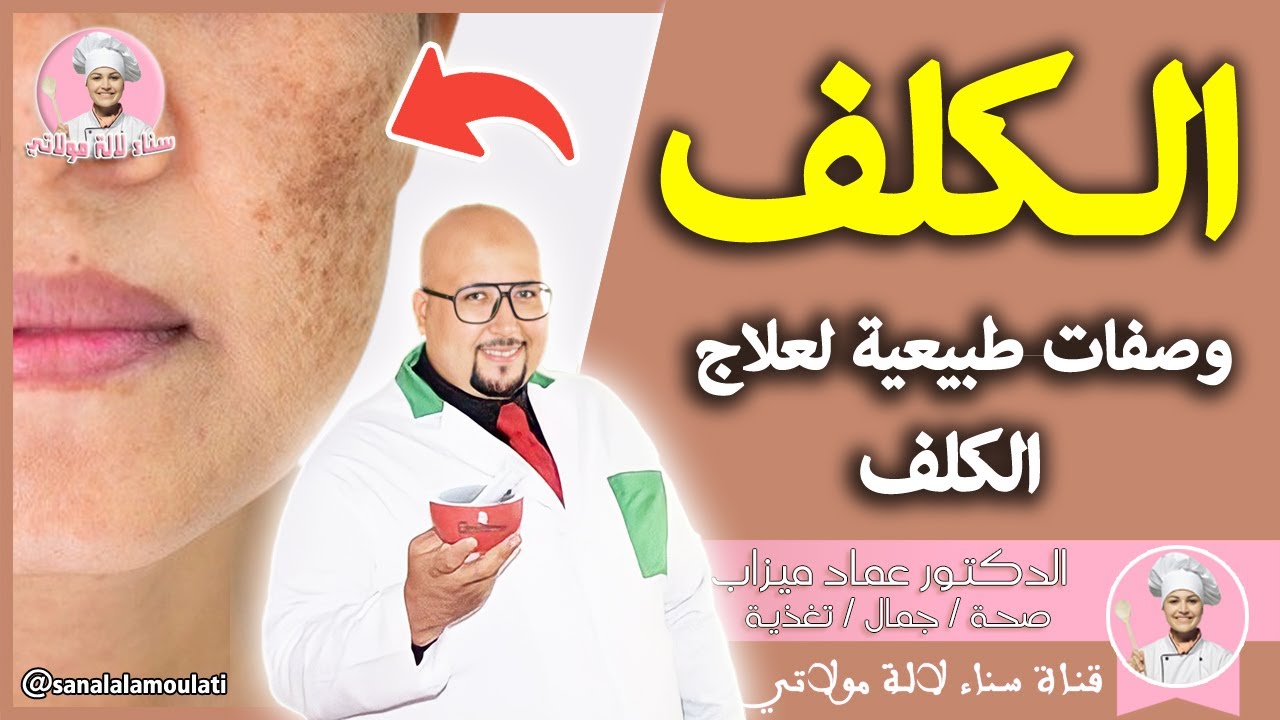 مشكل الكلف وكيفاش نعالجوه بوصفات طبيعية من عند الدكتور عماد ميزاب imad mizab