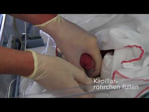 Capillary sampling on neonates for blood gas analysis (German subtitles)