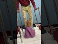 L3-L4,L4-L5 disc & back pain treatment #backpainrelief #backpbackpack r#backpainexercises #backache