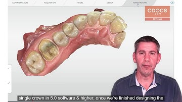 Tip of the Day: Overmilling