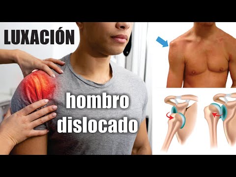 LUXACIÓN DE HOMBRO 💪🏼 trata el hombro dislocado 💪🏼 Glenohumeral Acromioclavicular ⭐ Dr EDSON SERRANO