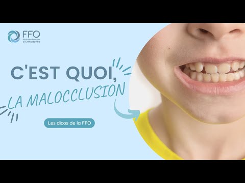 Vidéo : Orthodontie : c'est quoi, la malocclusion ?