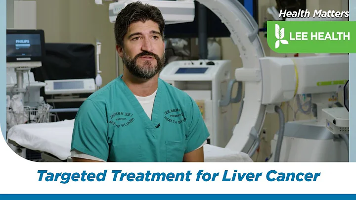 TARE-Y90 A Targeted Treatment for Liver Cancer