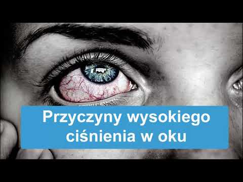 Wideo: Ciśnienie Za Okiem: Przyczyny, Leczenie I Nie Tylko