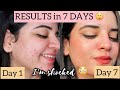 I used THIS for 7 days for my acne & look what happened(Shocking results) 😳eclat acne edit*GIVEAWAY*