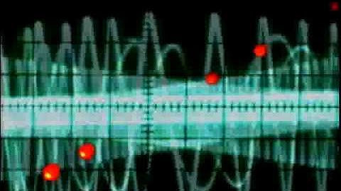 EMS - music by ems / video by extraG