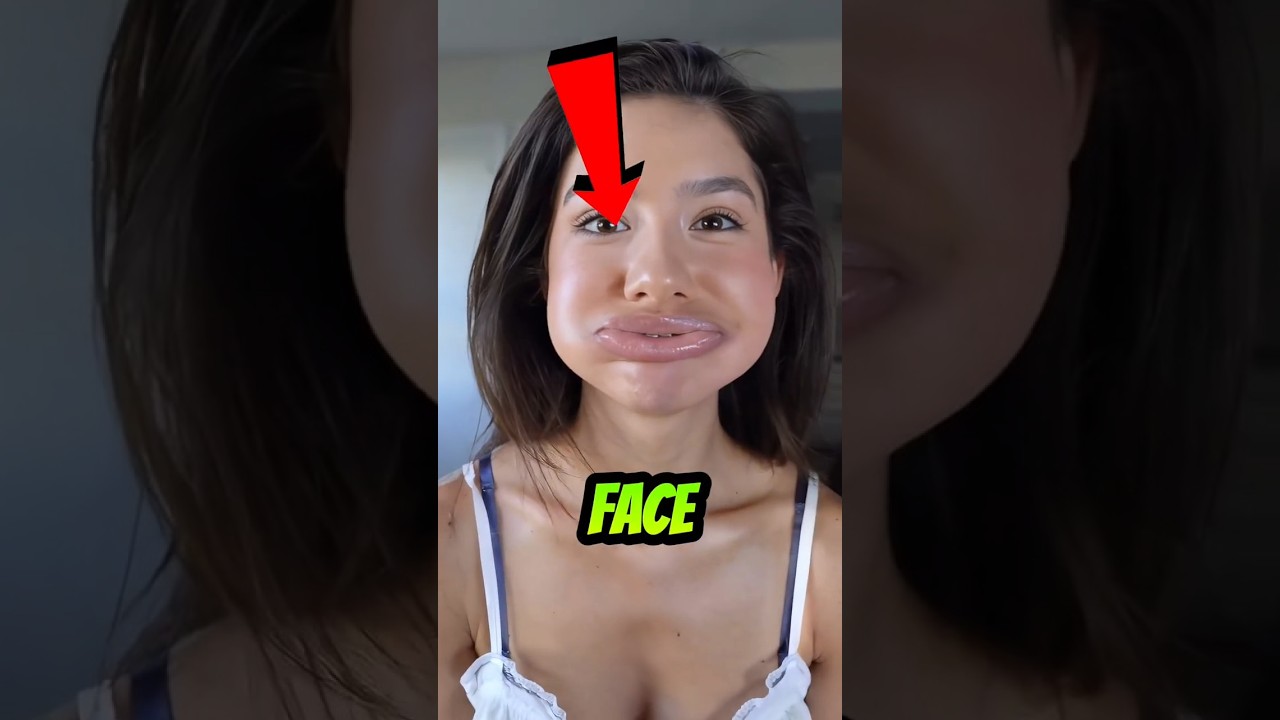 Пчела ужалила ее в лицо... А потом оттуда выползло ВОТ ЭТО 😰