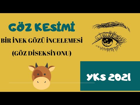 Video: Goz Kostryulasi