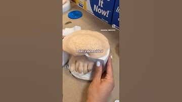 FLEX FOAM-iT X expanding FLEXIBLE PU foam. ALGINATE copy of foot, and casting by FLEX FOAM pigmented