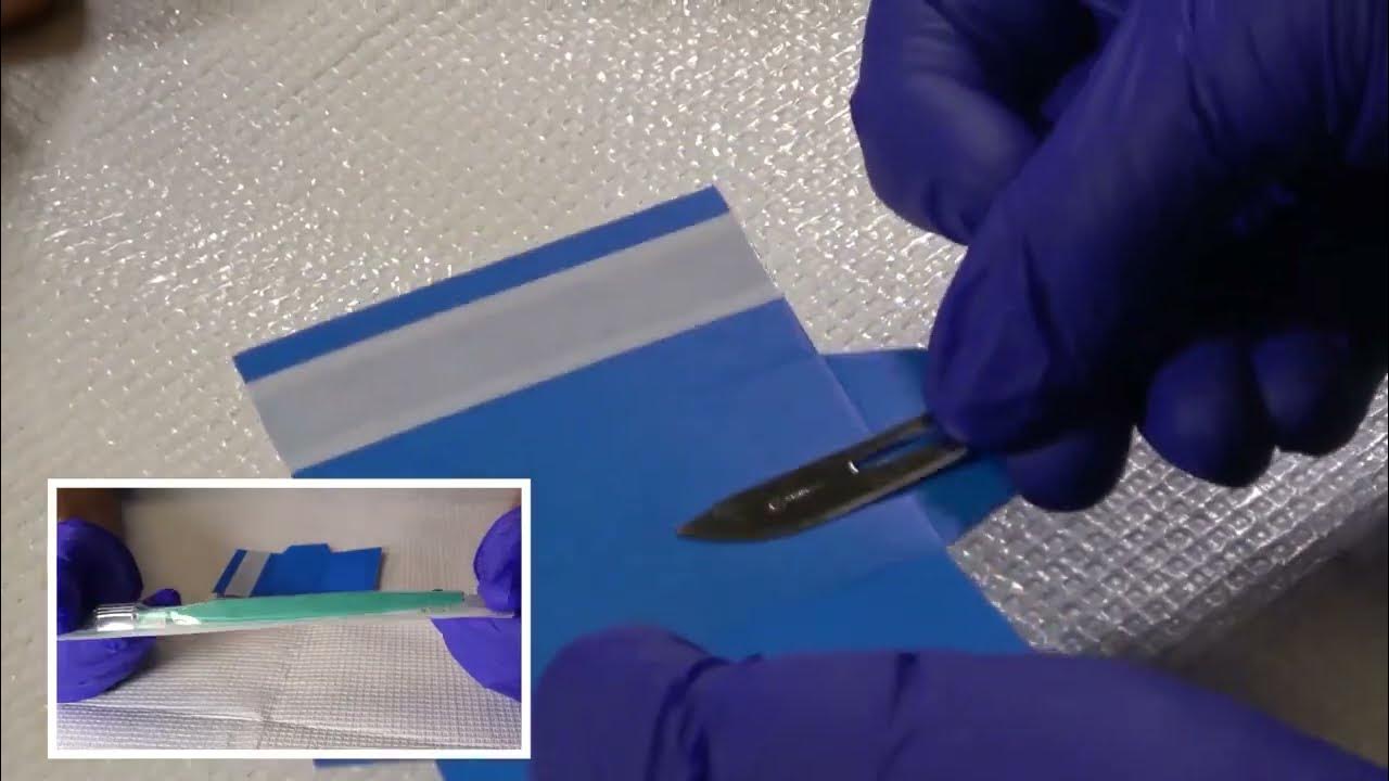  Space Specimen Collection is a Simple Skin Scrape Procedure YouTube