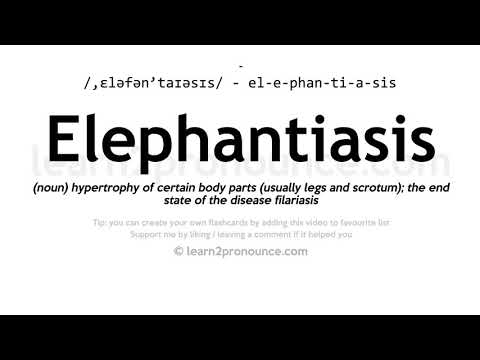 Udtale af elephantiasis | Definition af Elephantiasis